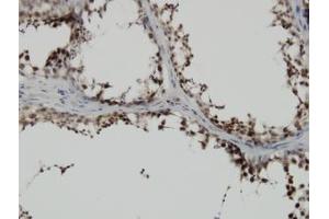 Image no. 1 for anti-PDZ Binding Kinase (PBK) (AA 1-110) antibody (ABIN599272) (PBK anticorps  (AA 1-110))