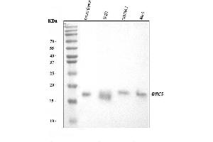 Western blot analysis of Survivin using anti-Survivin antibody (ABIN3043511).