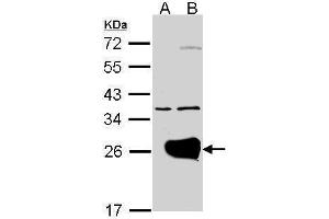 WB Image Western Blot analysis of RAB1A expression in transfected 293T cell line by RAB1A polyclonal antibody. (RAB1A anticorps)