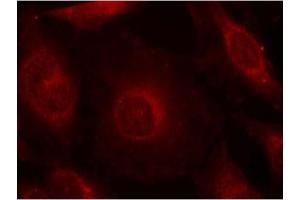 Image no. 2 for anti-V-Akt Murine Thymoma Viral Oncogene Homolog 1 (AKT1) (pTyr312), (pTyr315), (pTyr316) antibody (ABIN319269) (AKT1 anticorps  (pTyr312, pTyr315, pTyr316))