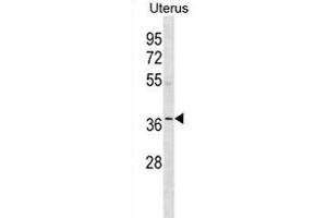 OR5W2 Antibody (C-term) (ABIN1881607 and ABIN2838752) western blot analysis in human Uterus tissue lysates (35 μg/lane). (OR5W2 anticorps  (C-Term))