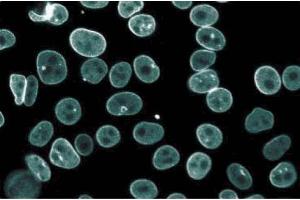 Immunofluorescence staining of HeLa cells (Human cervical epitheloid carcinoma, ATCC CCL-2. (Thymopoietin anticorps  (AA 34-156))