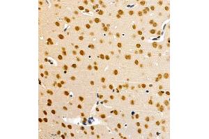 Immunohistochemistry of paraffin embedded mouse brain using HES3 (ABIN7074159) at dilution of 1:1000 (400x lens) (HES3 anticorps)