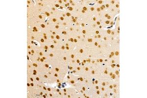 Immunohistochemistry of paraffin embedded mouse brain using HES3 (ABIN7074159) at dilution of 1:1000 (400x lens)