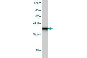 Western Blot detection against Immunogen (36. (INPPL1 anticorps  (AA 1159-1258))