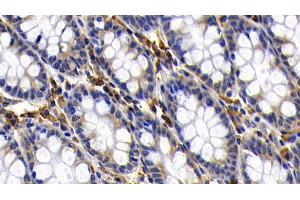 Detection of Bcl2L in Human Colon Tissue using Polyclonal Antibody to B-Cell CLL/Lymphoma 2 Like Protein (Bcl2L)