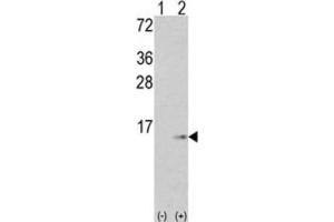 Western Blotting (WB) image for anti-S100 Calcium Binding Protein A6 (S100A6) antibody (ABIN3003159) (S100A6 anticorps)