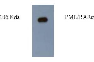 Western Blotting (WB) image for anti-Promyelocytic Leukemia (PML) antibody (ABIN452172) (PML anticorps)