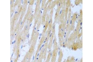 Immunohistochemistry of paraffin-embedded Rat heart using UBE2L3 Polyclonal Antibody at dilution of 1:100 (40x lens). (UBE2L3 anticorps)
