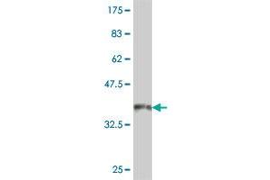 Western Blot detection against Immunogen (37.