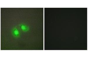 Immunofluorescence analysis of A549 cells, using TOP2A antibody. (Topoisomerase II alpha anticorps  (N-Term))
