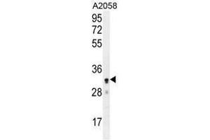 UBXN2A Antibody (C-term) western blot analysis in A2058 cell line lysates (35 µg/lane). (UBXN2A anticorps  (C-Term))