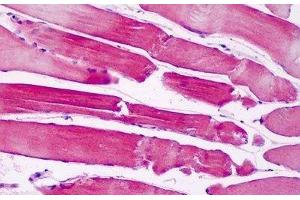 Human Skeletal Muscle: Formalin-Fixed, Paraffin-Embedded (FFPE) (PAK6 anticorps  (AA 268-297))