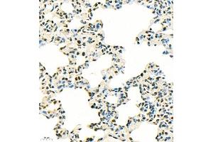 Immunohistochemistry of paraffin embedded rat lung using SUV39H1 (ABIN7075770) at dilution of 1:500 (400x lens) (SUV39H1 anticorps)