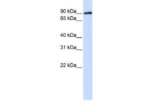 Western Blotting (WB) image for anti-DNA Cross-Link Repair 1C (DCLRE1C) antibody (ABIN2459465) (DCLRE1C anticorps)