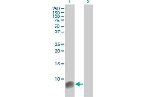 Western Blot analysis of S100A6 expression in transfected 293T cell line by S100A6 monoclonal antibody (M10), clone 6B5.