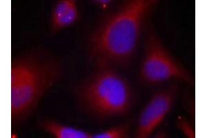 Immunofluorescence staining of methanol-fixed Hela cells using MARCKS(Phospho-Ser158) Antibody. (MARCKS anticorps  (pSer158))
