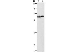 Western Blotting (WB) image for anti-Aminolevulinate, delta-, Synthase 2 (ALAS2) antibody (ABIN2422513) (ALAS2 anticorps)