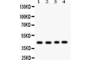 Western Blotting (WB) image for anti-Tumor Susceptibility Gene 101 (TSG101) (AA 361-390), (C-Term) antibody (ABIN3042318)