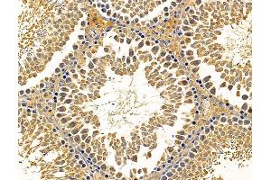 ABIN7095701 and ABIN7099763 at 1/100 staining rat testis tissue by IHC-P.