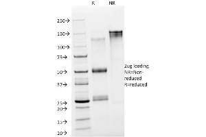 SDS-PAGE Analysis Purified NSE gamma Mouse Monoclonal Antibody (NSE-P2).