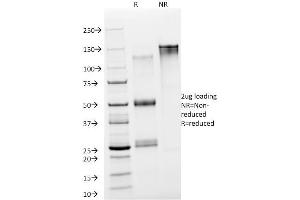 SDS-PAGE Analysis Purified NSE gamma Mouse Monoclonal Antibody (NSE-P2). (ENO2/NSE anticorps  (AA 416-433))