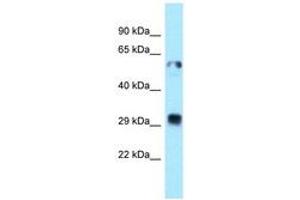 Image no. 1 for anti-Thioredoxin-Related Transmembrane Protein 1 (TMX1) (C-Term) antibody (ABIN6747966) (TMX1 anticorps  (C-Term))