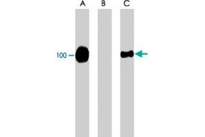 Western blot of Jurkat cells expressing CFL1. (Cofilin anticorps  (pSer3))