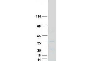 Validation with Western Blot