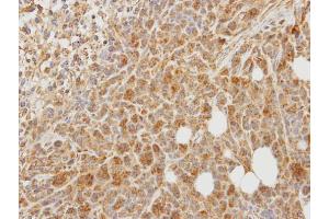 IHC-P Image Immunohistochemical analysis of paraffin-embedded SAS xenograft, using PCPE-1, antibody at 1:100 dilution.