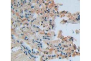 IHC-P analysis of Human Tissue, with DAB staining. (TIE1 anticorps  (AA 701-898))
