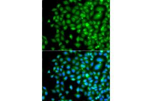 Immunofluorescence analysis of A549 cell using PAK2 antibody. (PAK2 anticorps)
