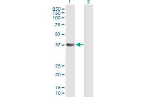 Western Blot analysis of PDS5A expression in transfected 293T cell line by PDS5A MaxPab polyclonal antibody. (PDS5A anticorps  (AA 1-333))
