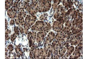 Image no. 2 for anti-Mannose Phosphate Isomerase (MPI) antibody (ABIN1499543)