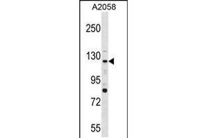 Western blot analysis in A2058 cell line lysates (35ug/lane). (PTPRN2 anticorps  (N-Term))