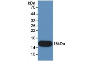 Detection of Recombinant CTGF, Human using Monoclonal Antibody to Connective Tissue Growth Factor (CTGF) (CTGF anticorps  (AA 80-200))
