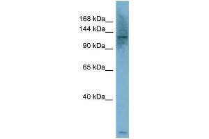 WB Suggested Anti-PLCB1  Antibody Titration: 0.