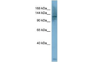 WB Suggested Anti-PLCB1  Antibody Titration: 0. (Phospholipase C beta 1 anticorps  (Middle Region))