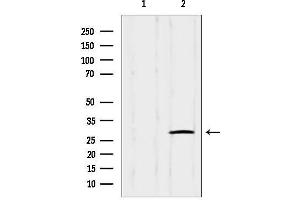 anti-Insulin-Like Growth Factor Binding Protein-Like 1 (IGFBPL1) (Internal Region) antibody