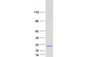 Validation with Western Blot