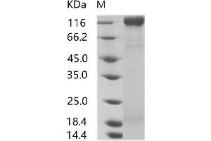 Human Immunodeficiency Virus ENV (HIV-1 gp160) protein (His tag)