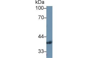 Detection of PDHb in Human Serum using Polyclonal Antibody to Pyruvate Dehydrogenase Beta (PDHb)