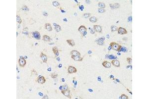 Immunohistochemistry of paraffin-embedded Rat brain using DLG1 Polyclonal Antibody at dilution of 1:100 (40x lens). (DLG1 anticorps)
