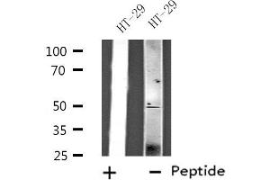Western blot analysis of extracts from HT-29 cells, using ZFYVE19 antibody. (ZFYVE19 anticorps  (Internal Region))