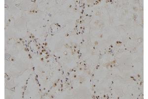 ABIN6264480 and ABIN6277000 at 1/100 staining Human lung tissue by IHC-P. (PSMC3 anticorps  (Internal Region))