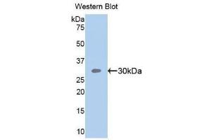 Western Blotting (WB) image for anti-Sema Domain, Seven Thrombospondin Repeats (Type 1 and Type 1-Like), Transmembrane Domain (TM) and Short Cytoplasmic Domain, (Semaphorin) 5B (SEMA5B) (AA 350-602) antibody (ABIN1860526) (SEMA5B anticorps  (AA 350-602))