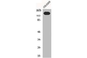 Western Blot analysis of C0L0205 cells using N-cadherin Polyclonal Antibody