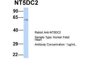 Host:  Rabbit  Target Name:  NT5DC2  Sample Type:  Human Fetal Heart  Antibody Dilution:  1. (NT5DC2 anticorps  (N-Term))