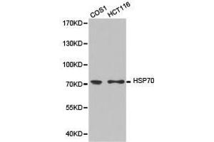 Western Blotting (WB) image for anti-Heat Shock Protein 70 (HSP70) antibody (ABIN1873094) (HSP70 anticorps)