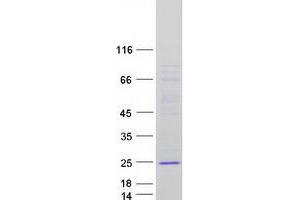 Validation with Western Blot